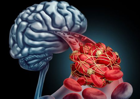 وقتی چند دقیقه می‌تواند سرنوشت یک بیمار را تغییر دهد